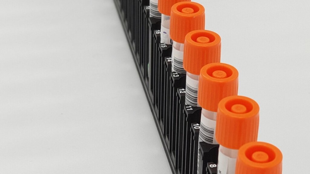 CMS proposes Medicare lab cuts to save $1Bn a year | Outsource Accelerator